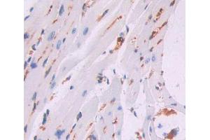 Used in DAB staining on fromalin fixed paraffin- embedded heart tissue (CCRK anticorps  (AA 4-288))