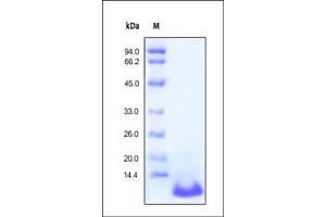 Human C5a, Tag Free on SDS-PAGE under reducing (R) condition. (C5A Protein (AA 679-751))