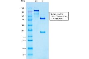 SDS-PAGE Analysis Purified S100B-Monospecific Recombinant Rabbit Monoclonal Antibody (S100B/1706R).