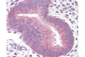Anti-14-3-3 antibody IHC of human uterus.