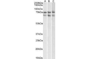 ABIN2613433 (2µg/ml) staining of HeLa (A)HepG2 (B) and K562 (C) nuclear lysates (35µg protein in RIPA buffer). (Nucleostemin anticorps  (Internal Region))
