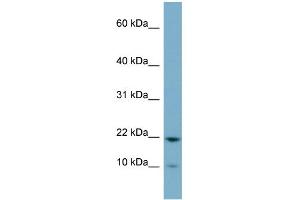 WB Suggested Anti-D15Wsu75e Antibody Titration:  0. (DESI1 anticorps  (Middle Region))