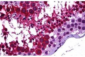 Human Testis: Formalin-Fixed, Paraffin-Embedded (FFPE) (GALR3 anticorps  (AA 349-362))