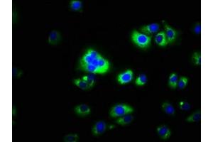 Immunofluorescence staining of A549 cells with ABIN7146518 at 1:100, counter-stained with DAPI. (CAPNS2 anticorps  (AA 1-248))