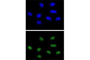 Confocal immunofluorescent analysis of PIN1 antibody with 293 cells followed by Alexa Fluor 488-conjugated goat anti-rabbit lgG (green).