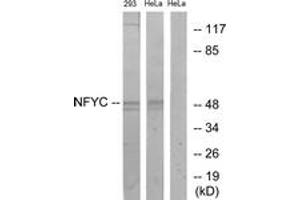 Western Blotting (WB) image for anti-Nuclear Transcription Factor Y, gamma (NFYC) (AA 1-50) antibody (ABIN2890476) (NFYC anticorps  (AA 1-50))