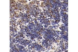 Immunohistochemistry analysis of paraffin-embedded mouse thymus using,MLLT11 (ABIN7074715) at dilution of 1: 4000 (MLLT11 anticorps)