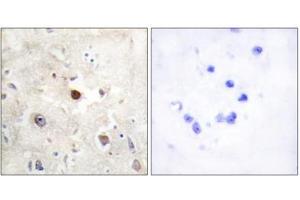 Immunohistochemistry analysis of paraffin-embedded human brain tissue, using p57KIP2 antibody. (CDKN1C anticorps  (N-Term))