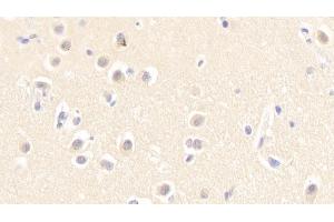 Detection of NTRK3 in Human Cerebrum Tissue using Polyclonal Antibody to Neurotrophic Tyrosine Kinase Receptor Type 3 (NTRK3)
