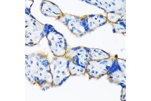Immunohistochemistry of paraffin-embedded human placenta using Dysferlin (Romeo) Rabbit mAb (ABIN7266868) at dilution of 1:100 (40x lens).