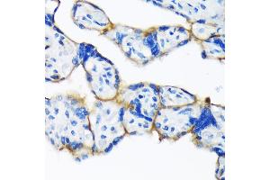 Immunohistochemistry of paraffin-embedded human placenta using Dysferlin (Romeo) Rabbit mAb (ABIN7266868) at dilution of 1:100 (40x lens). (Dysferlin anticorps)