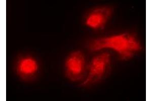 Immunofluorescent analysis of LKB1 staining in A431 cells. (LKB1 anticorps  (C-Term))