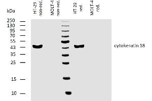 anti-Keratin 18 (KRT18) antibody