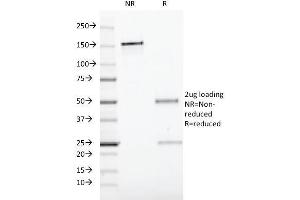 SDS-PAGE Analysis Purified CD19 Mouse Monoclonal Antibody (CVID3/429).