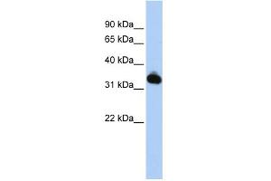 WB Suggested Anti-GALM Antibody Titration: 0. (GALM anticorps  (N-Term))