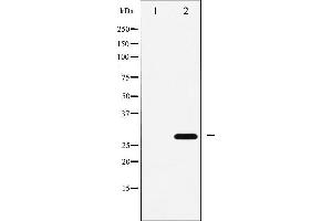 Western blot analysis of p27 Kip1 expression in EGF treated HeLa whole cell lysates,The lane on the left is treated with the antigen-specific peptide. (CDKN1B anticorps  (C-Term))