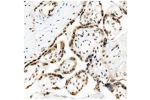 IHC analysis of KAP1/TRIM28 using anti-KAP1/TRIM28 antibody (ABIN7602310). (KAP1 anticorps  (AA 699-835))