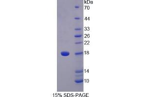 SDS-PAGE analysis of Human STAT5A Protein. (STAT5A Protéine)