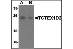 Western blot analysis of TCTEX1D2 in K562 cell lysate with TCTEX1D2at 1 ug/mL in (A) the absence and (B) the presence of blocking peptide. (TCTEX1D2 anticorps  (N-Term))