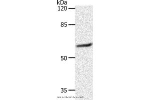 Western blot analysis of 231 cell, using SLC16A4 Polyclonal Antibody at dilution of 1:1200 (SLC16A4 anticorps)