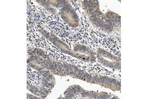 IHC analysis of EYA4 using anti-EYA4 antibody (ABIN7601063). (EYA4 anticorps  (AA 28-205))