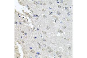 Immunohistochemistry of paraffin-embedded mouse brain using PKN1 antibody at dilution of 1:100 (x40 lens). (PKN1 anticorps)