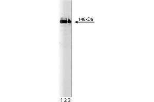 Western Blotting (WB) image for anti-phospholipase C, gamma 1 (PLCG1) (AA 82-100) antibody (ABIN967699)