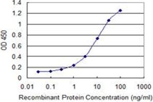Detection limit for recombinant GST tagged SULT2B1 is 0.