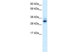 Western Blotting (WB) image for anti-Zinc Finger Protein 654 (ZNF654) antibody (ABIN2460661) (ZNF654 anticorps)