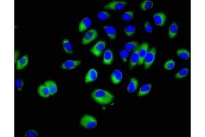 Immunofluorescent analysis of A549 cells using ABIN7143272 at dilution of 1:100 and Alexa Fluor 488-congugated AffiniPure Goat Anti-Rabbit IgG(H+L)