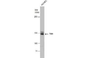 WB Image TIE1 antibody detects TIE1 protein by western blot analysis. (TIE1 anticorps)