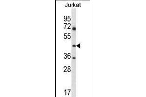 ASS1 Antibody (C-term) (ABIN656537 and ABIN2845801) western blot analysis in Jurkat cell line lysates (35 μg/lane). (ASS1 anticorps  (C-Term))