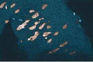 Immunohistochemical staining of a rabbit cerebrum section.