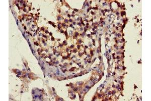 Immunohistochemistry of paraffin-embedded human testis tissue using ABIN7151350 at dilution of 1:100 (ART3 anticorps  (AA 279-352))