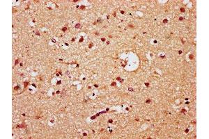 IHC image of ABIN7172459 diluted at 1:300 and staining in paraffin-embedded human brain tissue performed on a Leica BondTM system.