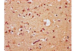 IHC image of ABIN7172459 diluted at 1:300 and staining in paraffin-embedded human brain tissue performed on a Leica BondTM system. (HNF1B anticorps  (AA 539-704))