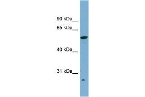 WB Suggested Anti-ALDH3A2 Antibody Titration:  0. (ALDH3A2 anticorps  (Middle Region))