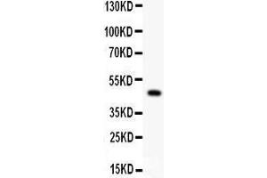 Anti- P2X5 Picoband antibody, Western blotting All lanes: Anti P2X5  at 0.