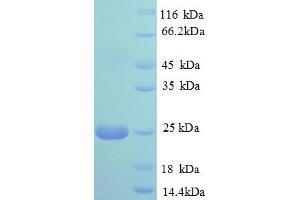 SDS-PAGE (SDS) image for Polymeric Immunoglobulin Receptor (PIGR) (AA 399-599), (partial) protein (His tag) (ABIN5710097)