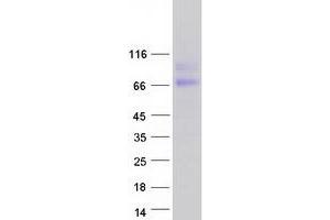 Validation with Western Blot