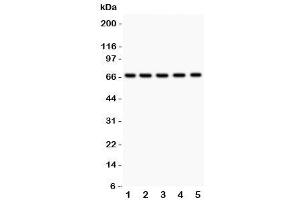 Western blot testing of HNF1A antibody and Lane 1:  rat liver (HNF1A anticorps  (AA 431-631))