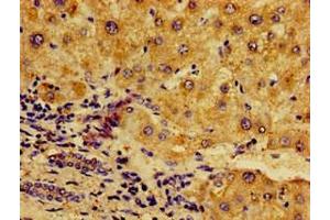 Immunohistochemistry of paraffin-embedded human liver tissue using ABIN7161777 at dilution of 1:100 (NFKB2 anticorps  (AA 263-439))