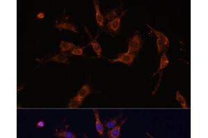 Immunofluorescence analysis of C6 cells using IQGAP1 Polyclonal Antibody at dilution of 1:100 (40x lens). (IQGAP1 anticorps)
