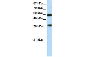 WB Suggested Anti-ARID3B  Antibody Titration: 0. (ARID3B anticorps  (C-Term))
