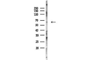 anti-Coagulation Factor XII (F12) (C-Term) antibody