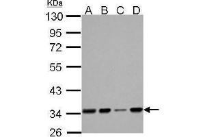 WB Image HADH antibody detects HADH protein by Western blot analysis.