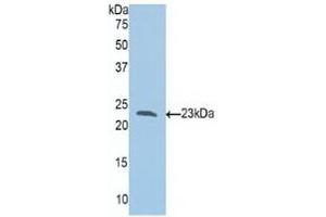 Detection of Recombinant Slit1, Human using Polyclonal Antibody to Slit Homolog 1 (Slit1)