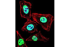Fluorescent confocal image of Hela cell stained with HDAC2 Antibody (Center) (ABIN653718 and ABIN2843029). (HDAC2 anticorps  (AA 410-439))