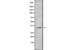 Western blot analysis OR5AT1 using COLO205 whole cell lysates (OR14A16 anticorps  (Internal Region))