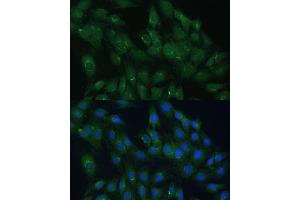 Immunofluorescence analysis of C6 cells using  Polyclonal Antibody (ABIN7265476) at dilution of 1:100 (40x lens). (ARL1 anticorps  (AA 62-181))